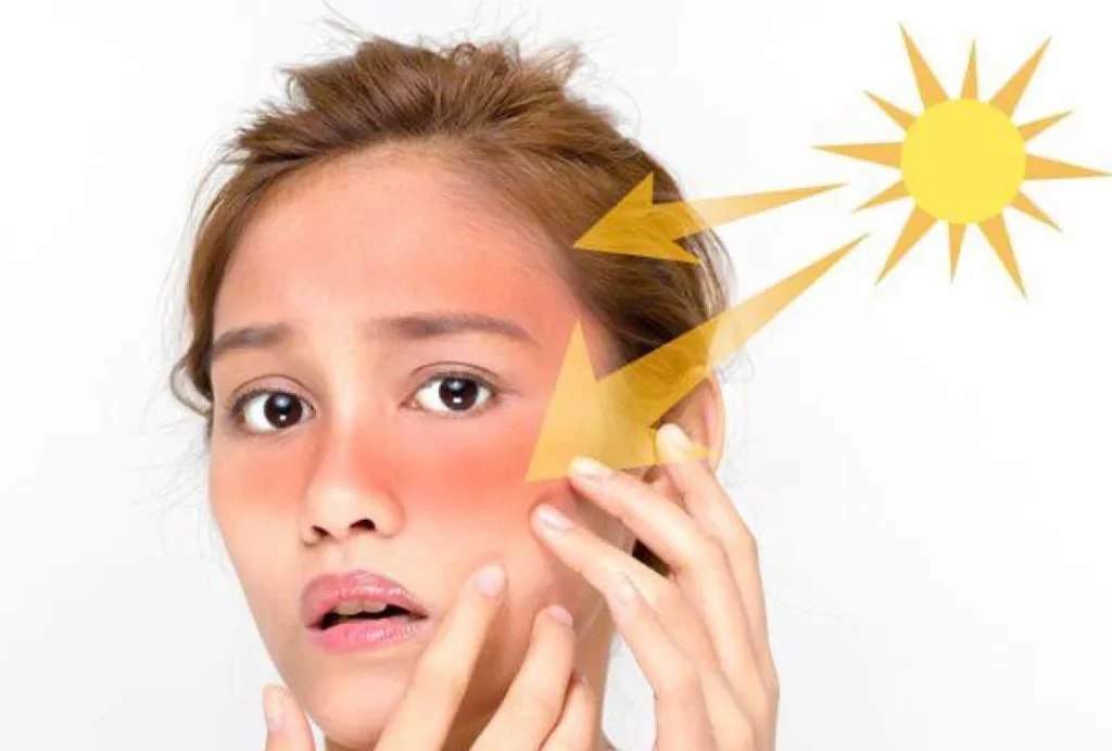 Rekomendasi Kandungan Sunscreen Terbaik untuk Kulit Sensitif