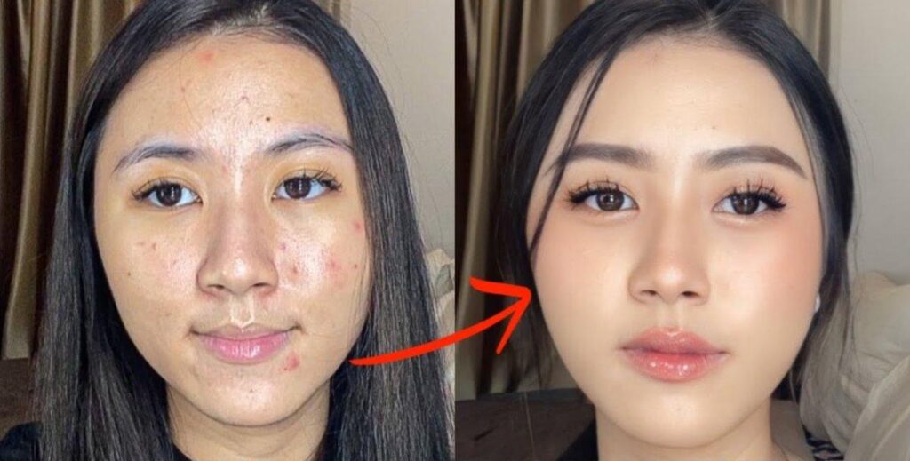 5 Tips Makeup Aman untuk Kulit Berjerawat