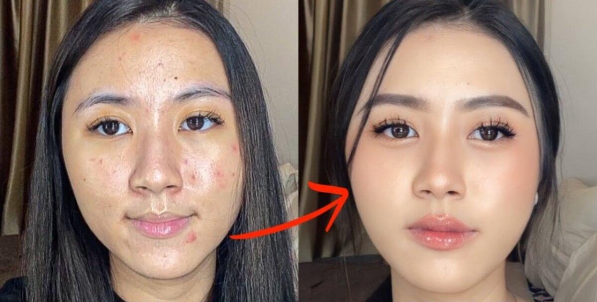5 Tips Makeup Aman untuk Kulit Berjerawat