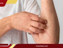 Waspada! Kasus Campak Melonjak di Sumenep