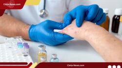 Kasus Campak Melonjak di Sulsel, 7 Kabupaten/Kota Masuk Zona KLB