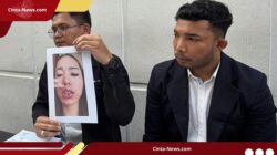 Modal Sertifikat, Finalis Puteri Indonesia Buka Praktik Kecantikan Ilegal